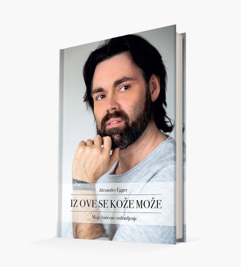 Iz ove se kože može